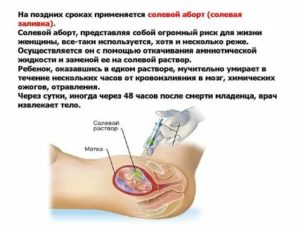 Можно ли забеременеть сразу после месячных при прерванном половом акте