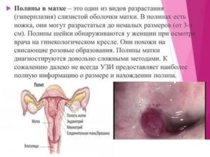 Можно ли загорать при эндометриозе шейки матки