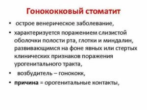 Что такое гонококковый стоматит