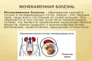 Что такое цистит и мочекаменной болезни