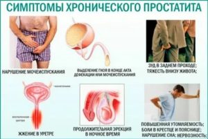 При хроническом простатите можно ли поднимать тяжести