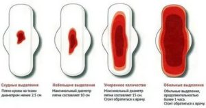 Откуда выходит кровь при менструации