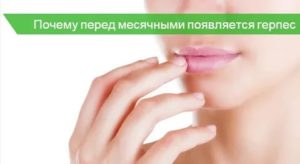 Почему герпес может появиться во время месячных