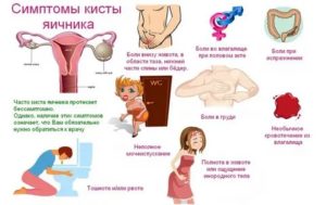 Почему могут болеть яичники у женщин после месячных