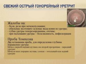Выделения из мочеиспускательного канала у мужчин при простатите