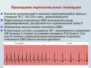 Почему перед месячными сердце сбивается с ритма