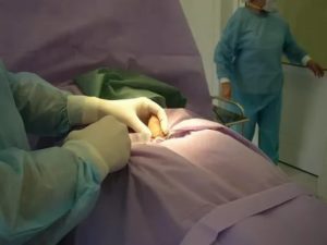 Сколько будет стоить операция на фимоз