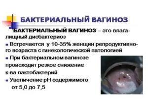 Можно ли забеременеть после гарднереллеза