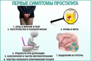 При хроническом простатите можно ли поднимать тяжести