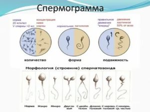 Может ли простатит влиять на морфологию сперматозоидов