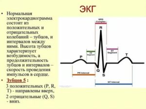 Можно ли делать кардиограмму во время месячных