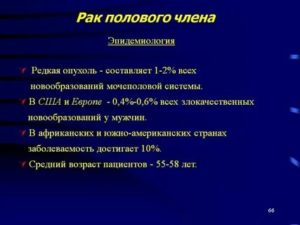 Какие анализы сдают на рак полового члена