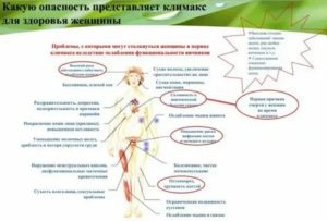 Как лечить хронический цистит при менопаузе