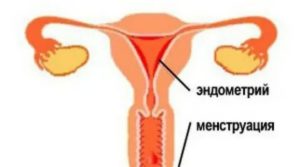 Что делать когда в день свадьбы пошли месячные