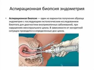 Когда приходят месячные после биопсии эндометрия