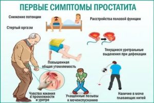 При хроническом простатите можно ли поднимать тяжести