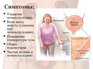 Почему часто хочется в туалет по маленькому у женщин перед месячными