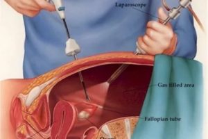 Когда должны пойти месячные после лапароскопии и гистероскопии