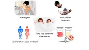 Можно ли при лечении цистита пить алкоголь
