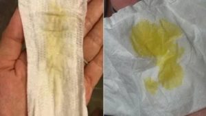 Почему когда заканчиваются месячные появляется неприятный запах