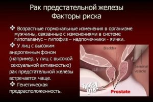 Причины психологические возникновения рака предстательной железы
