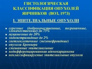 Что показывает гистология при раке яичников