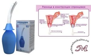Как правильно делать спринцевание в домашних условиях при молочнице грушей