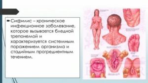 Можно ли работать с продуктами переболевшим сифилисом