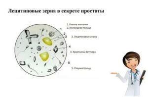 Лецитиновые зерна в моче после массажа простаты