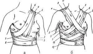 Какие нужны бинты на операцию молочной железы
