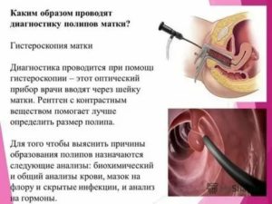 Сколько по времени делается гистероскопия эндометрия