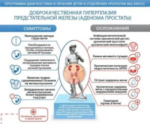 Признаки заболевания предстательной железы симптомы и лечение