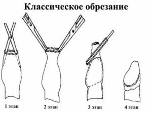 Как открыть член без операции