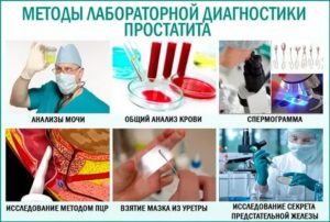 Способы диагностики при простатите