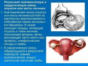 Хирургическая ножка опухоли яичника включает в себя