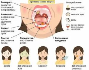 Почему пахнет изо рта во время месячных