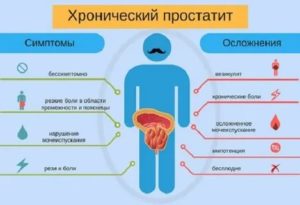 Прогноз лечения хронического простатита