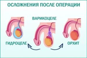 Почему держится температура после операции гидроцеле