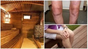 Можно ли париться в бане при вич