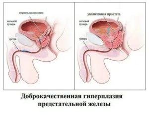 Органотропное действие на предстательную железу что это