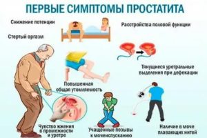 Сколько длится приступ простатита