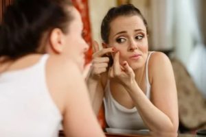 Как избавиться от прыщей во время месячных в домашних условиях