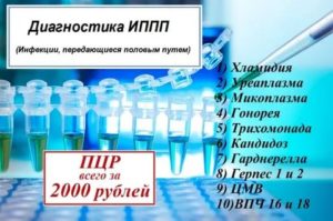 Что такое обследование на иппп метод пцр