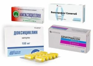 Способы лечения простатита у мужчин и какие лекарства принимать при