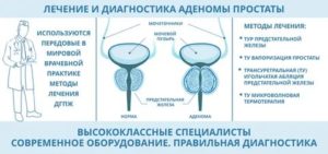 Лечение аденомы предстательной железы солевыми повязками