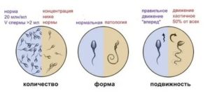 Может ли простатит влиять на морфологию сперматозоидов