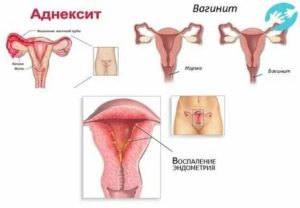 Почему во время месячных болит поясница и болит грудь