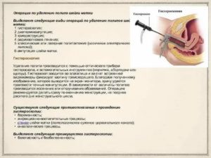 Температура после гистероскопия матки отзывы