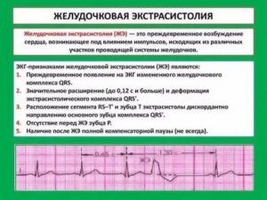 Могут ли быть в месячные экстрасистолы