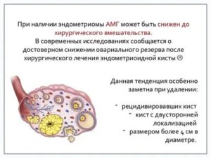 Каким может быть са-125 при эндометриоидной кисте яичника